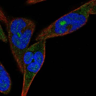 Immunocytochemistry/ Immunofluorescence: ZNF583 Antibody [NBP2-48570]