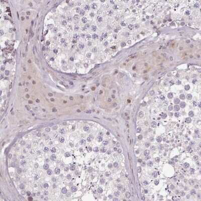 Immunohistochemistry-Paraffin: ZNF583 Antibody [NBP2-48568]