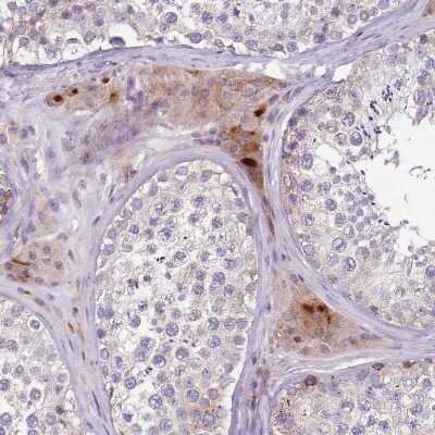 Immunohistochemistry-Paraffin: ZNF583 Antibody [NBP2-48570]