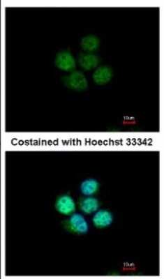 Immunocytochemistry/ Immunofluorescence: ZNF587 Antibody [NBP2-21030]