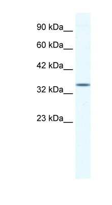Western Blot: ZNF589 Antibody [NBP1-80274]