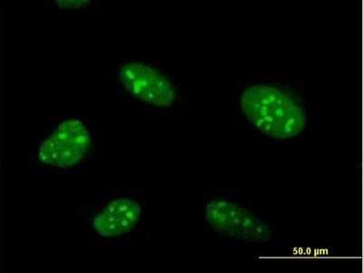 Immunocytochemistry/ Immunofluorescence: ZNF593 Antibody [H00051042-B02P]