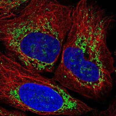 Immunocytochemistry/ Immunofluorescence: ZNF596 Antibody [NBP2-49183]