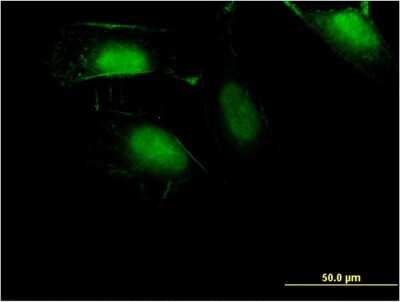 Immunocytochemistry/ Immunofluorescence: ZNF598 Antibody (1E2) [H00090850-M11]