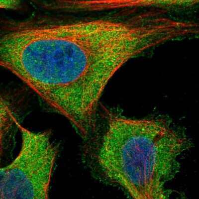 Immunocytochemistry/ Immunofluorescence: ZNF598 Antibody [NBP1-84659]