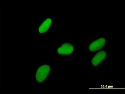 Immunocytochemistry/ Immunofluorescence: ZNF599 Antibody [H00148103-B01P]