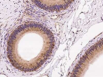 Immunohistochemistry-Paraffin: ZNF599 Antibody [NBP2-98118]