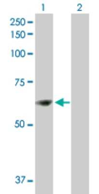 Western Blot: ZNF599 Antibody [H00148103-B01P]