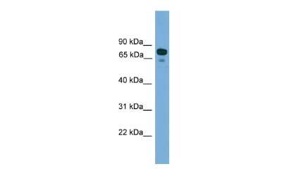 Western Blot: ZNF599 Antibody [NBP2-86530]
