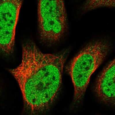 Immunocytochemistry/ Immunofluorescence: ZNF609 Antibody [NBP1-92634]