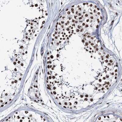 Immunohistochemistry-Paraffin: ZNF609 Antibody [NBP1-92633]