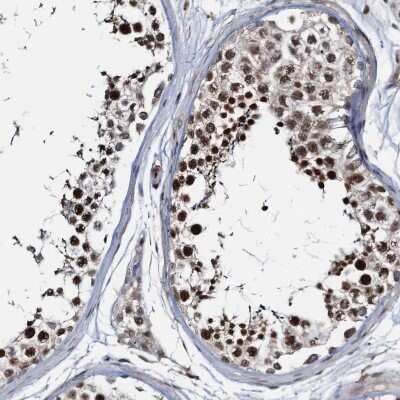 Immunohistochemistry-Paraffin: ZNF609 Antibody [NBP1-92634]