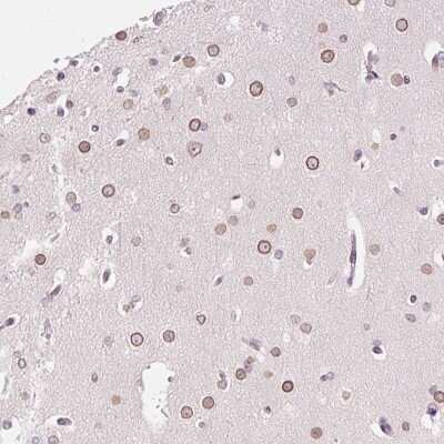 Immunohistochemistry: ZNF610 Antibody [NBP2-49192]