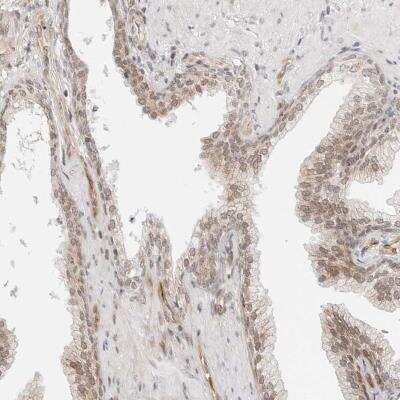 Immunohistochemistry: ZNF613 Antibody [NBP1-82250]