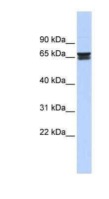 Western Blot: ZNF614 Antibody [NBP1-80370]