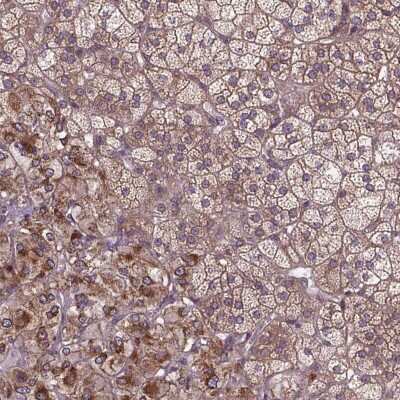 Immunohistochemistry: ZNF616 Antibody [NBP2-49662]