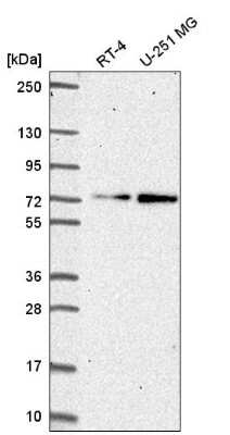 Western Blot: ZNF616 Antibody [NBP2-57531]