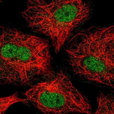 Immunocytochemistry/ Immunofluorescence: ZNF618 Antibody [NBP2-57450]