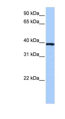 Western Blot: ZNF618 Antibody [NBP1-79410]