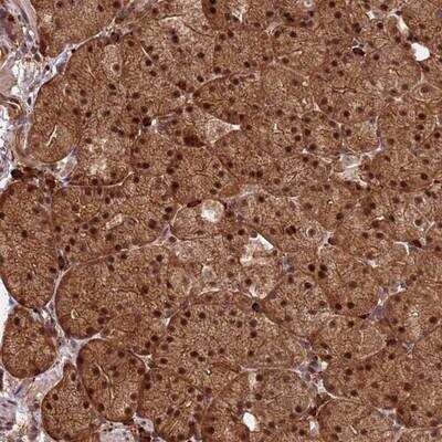 Immunohistochemistry-Paraffin: ZNF619 Antibody [NBP1-92636]