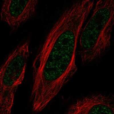 Immunocytochemistry/ Immunofluorescence: ZNF621 Antibody [NBP2-56433]