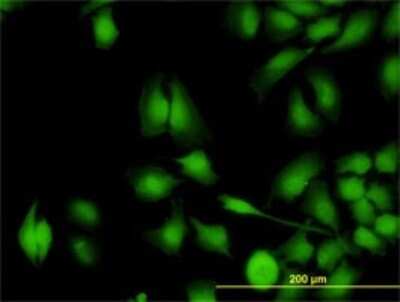 Immunocytochemistry/ Immunofluorescence: ZNF622 Antibody (3C5) [H00090441-M02]