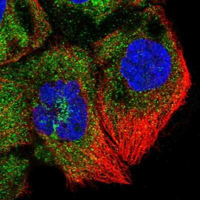 Immunocytochemistry/ Immunofluorescence: ZNF622 Antibody [NBP1-81183]