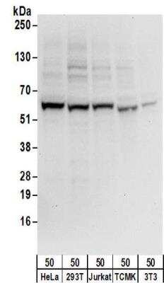 Western Blot: ZNF622 Antibody [NBP2-32087]