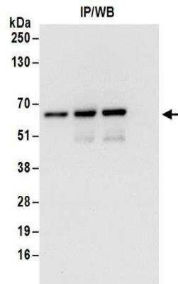 Western Blot: ZNF622 Antibody [NBP2-32102]