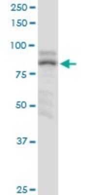 Western Blot: ZNF624 Antibody [H00057547-B01P]