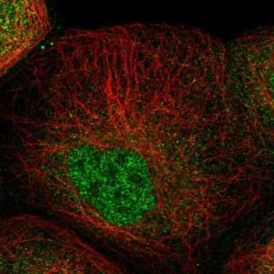 Immunocytochemistry/ Immunofluorescence: ZNF641 Antibody [NBP1-82022]