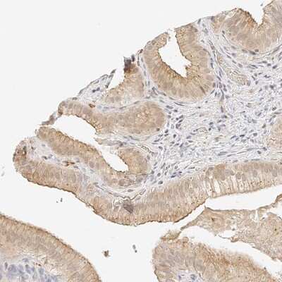 Immunohistochemistry-Paraffin: ZNF642 Antibody [NBP1-82215]