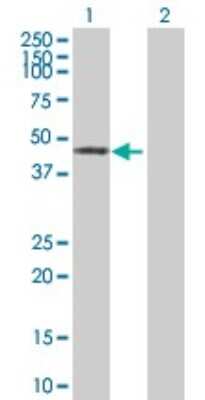 Western Blot: ZNF643 Antibody [H00065243-B01P]
