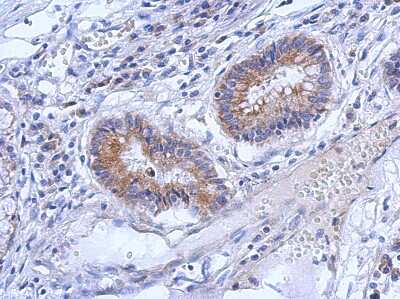 Immunohistochemistry-Paraffin: ZNF645 Antibody [NBP2-21037]