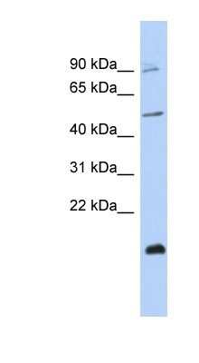 Western Blot: ZNF645 Antibody [NBP1-80410]