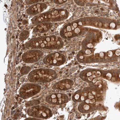 Immunohistochemistry-Paraffin: ZNF649 Antibody [NBP1-82288]