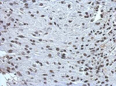 Immunohistochemistry-Paraffin: ZNF649 Antibody [NBP2-21038]