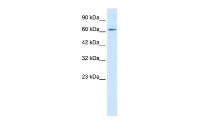 Western Blot: ZNF649 Antibody [NBP2-86543]
