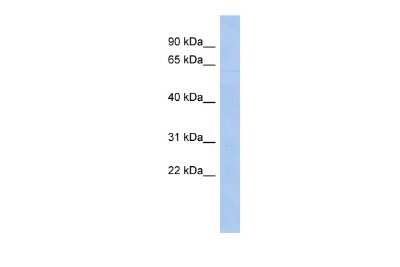 Western Blot: ZNF649 Antibody [NBP2-86544]