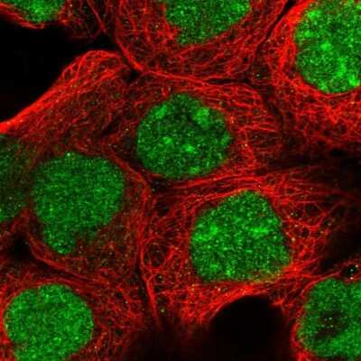 Immunocytochemistry/ Immunofluorescence: ZNF650 Antibody [NBP1-87996]