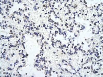 Immunohistochemistry-Paraffin: ZNF652 Antibody [NBP2-84360]