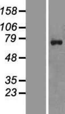 Western Blot: ZNF652 Overexpression Lysate [NBP2-09745]