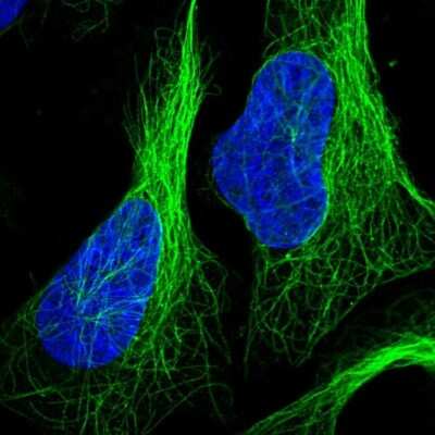 Immunocytochemistry/ Immunofluorescence: ZNF654 Antibody [NBP2-48653]