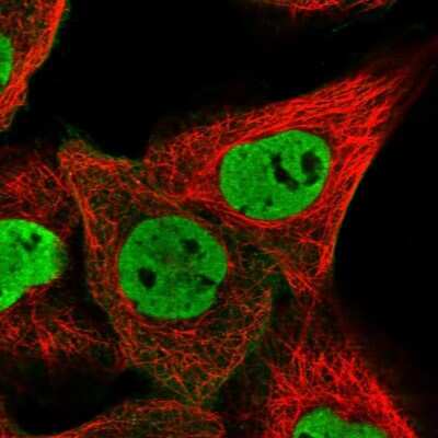 Immunocytochemistry/ Immunofluorescence: ZNF655 Antibody [NBP1-80625]