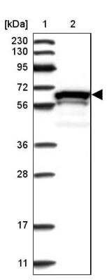 Western Blot: ZNF655 Antibody [NBP1-80625]