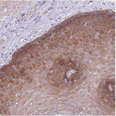 Immunohistochemistry: ZNF658 Antibody [NBP2-30748]