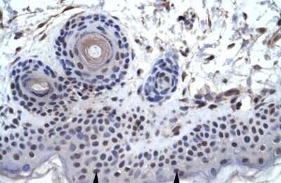 Immunohistochemistry-Paraffin: ZNF660 Antibody [NBP1-80190]