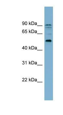 Western Blot: ZNF662 Antibody [NBP1-79439]
