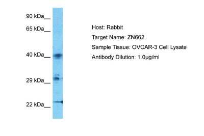 Western Blot: ZNF662 Antibody [NBP2-88722]