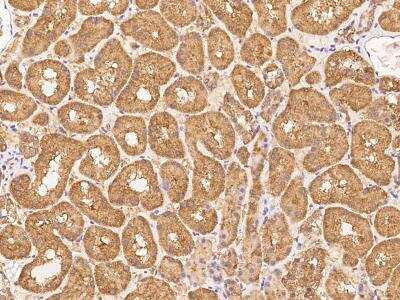 Immunohistochemistry-Paraffin: ZNF665 Antibody [NBP3-06044]